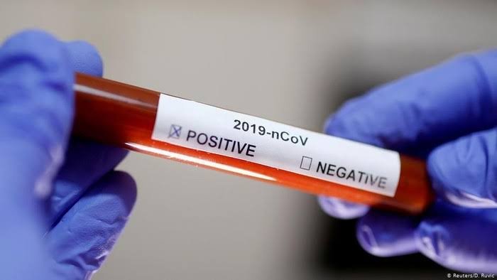 Kasus Positif Covid-19 di Lutra Kini Capai 44 Orang.