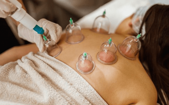 Klinik Bekam di Makassar